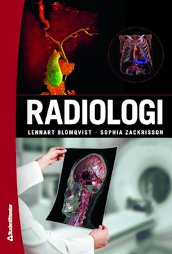Radiologi - (bok + digital produkt)