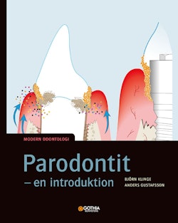 Parodontit : en introduktion