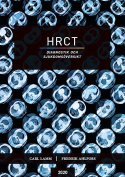 HRCT : diagnostik och sjukdomsöversikt